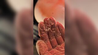 Pleasure gel analysis by a physician