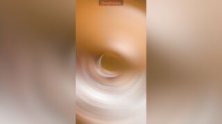 Doc, I fell on a fake penis!