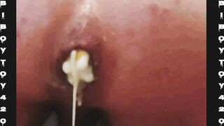 Super-steamy man ass fucking spunk clyster whit cream colored anal invasion rosebud.