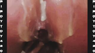 Super-steamy man ass fucking spunk clyster whit cream colored anal invasion rosebud.