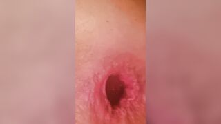 Anal invasion experiments