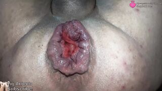 Rosebutt Fetish - Extraordinary Homemade Thick Culo Blossom