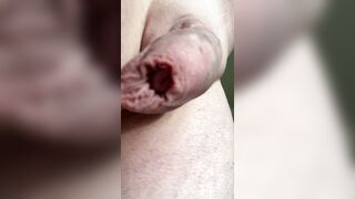 Sensitized uncircumcised penis, trimmed slick, good-sized foreskin, pulsating weenie and scrotum. Large vein. Close up.
