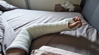 Lengthy forearm cast - Battered hand - Masturbatation