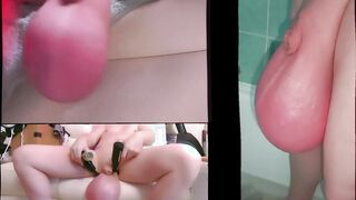 Extraordinary Ballstretching six Liter six Kilo Saline - Fattest Grown Testicles in the World - Ballstretcher Opened up Sack Meaty Testicles Real Life Hermaphroditism