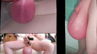 Extraordinary Ballstretching six Liter six Kilo Saline - Fattest Grown Testicles in the World - Ballstretcher Opened up Sack Meaty Testicles Real Life Hermaphroditism