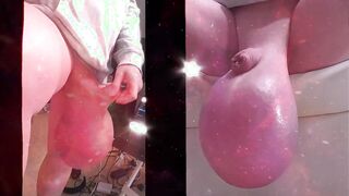 Wagging Real Ballsack Largest Ever Saline Nads Real Life Hermaphroditism Spread Plums Ball Spreading Loosening Joy Music Compilation
