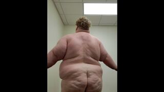 Gross Fatty Peels off in School Dormitory