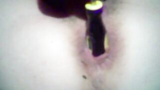 Masturbe (26) with one testicle