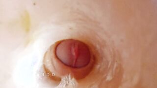 The guy found a way till locate beyond what happens indoors the anus pending fuck