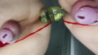 anal