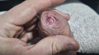 Uncircumcised Cock-squeezing Phimosis Manstick Foreskin Spread Close Up