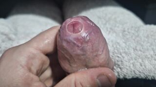 Uncircumcised Cock-squeezing Phimosis Manstick Foreskin Spread Close Up