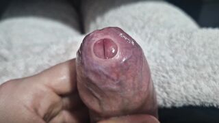Uncircumcised Cock-squeezing Phimosis Manstick Foreskin Spread Close Up