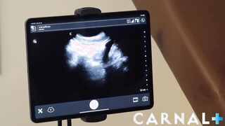 FunSizeBoys - Dr. Legrand Cub and nurse breed little ultrasound bottom