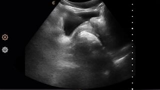 CARNAL PLUS Adam Snow Starlets In Deeper Deep Jaws, The Film Everyone Is Gulping